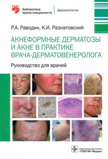 Обложка книги "Раводин, Разнатовский: Акнеформные дерматозы и акне в практике врача-дерматовенеролога. Руководство для врачей"