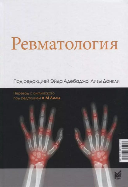 Обложка книги "Ревматология"
