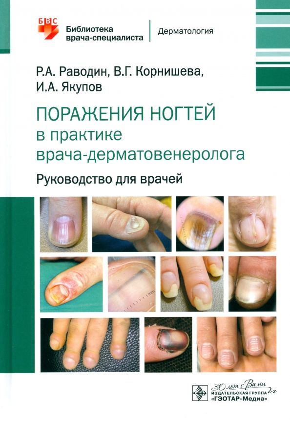 Обложка книги "Роман Раводин: Поражения ногтей в практике врача-дерматовенеролога. Руководство для врачей"