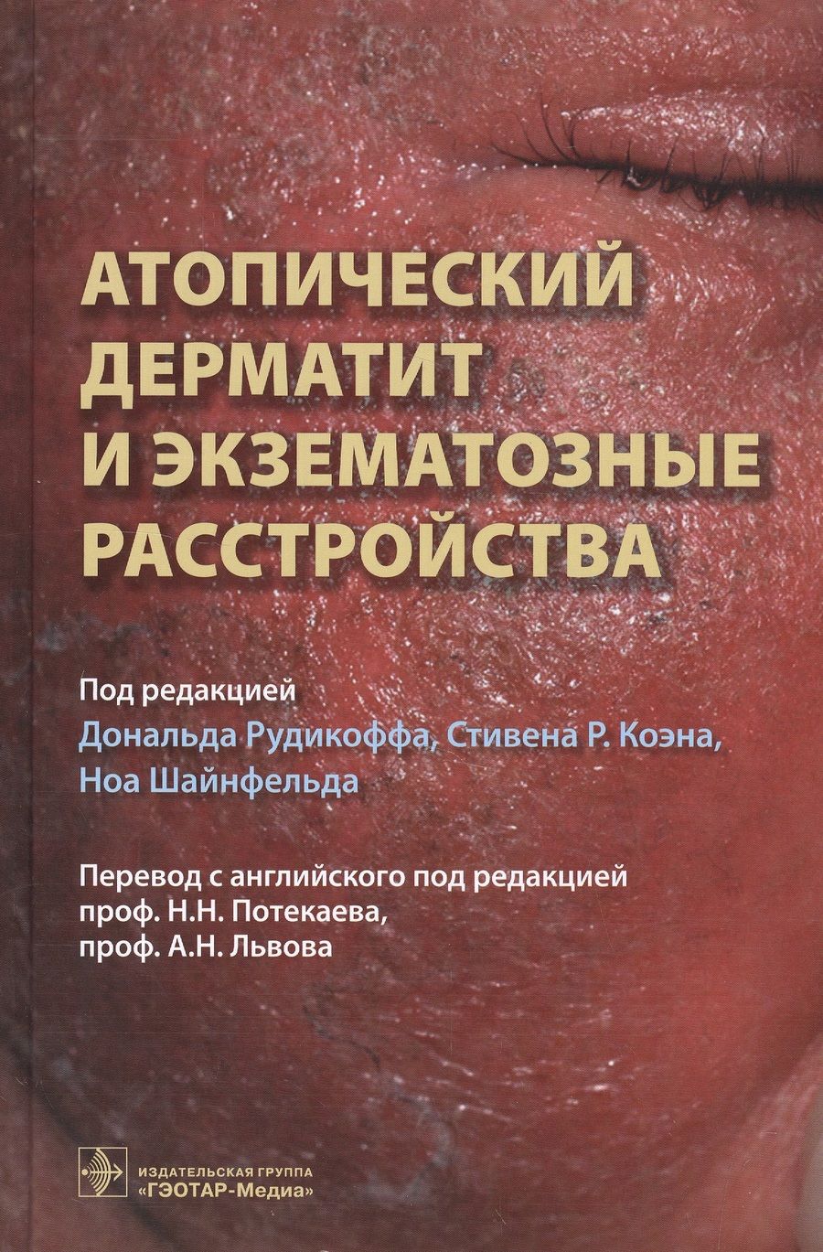 Обложка книги "Рудикофф, Коэн, Шайнфельд: Атопический дерматит и экзематозные расстройства"