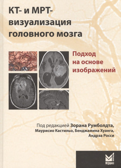 Обложка книги "Румболдт: КТ-и МРТ-визуализация головного мозга.подход на основе"