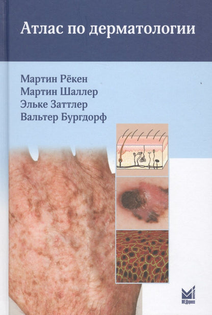 Обложка книги "Рёкен: Атлас по дерматологии"