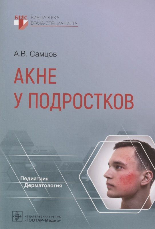 Обложка книги "Самцов: Акне у подростков. Руководство"