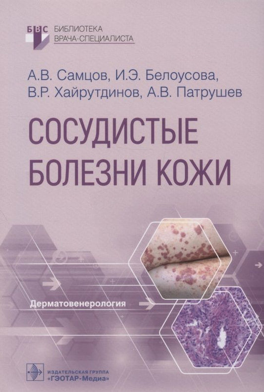 Обложка книги "Самцов, Белоусова, Патрушев: Сосудистые болезни кожи. Руководство"