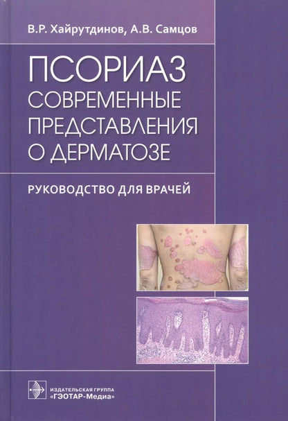 Обложка книги "Самцов, Хайрутдинов: Псориаз. Современные представления о дерматозе. Руководство для врачей."