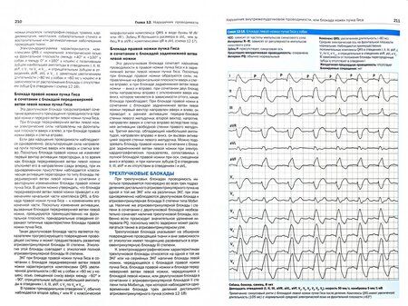 Фотография книги "Сантилли, Перего: Электрокардиография собак и кошек. Формирование и интерпретация сердечного ритма"