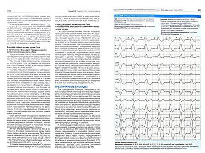 Фотография книги "Сантилли, Перего: Электрокардиография собак и кошек. Формирование и интерпретация сердечного ритма"