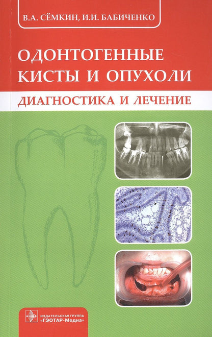 Обложка книги "Семкин, Бабиченко: Одонтогенные кисты и опухоли. Диагностика и лечение"
