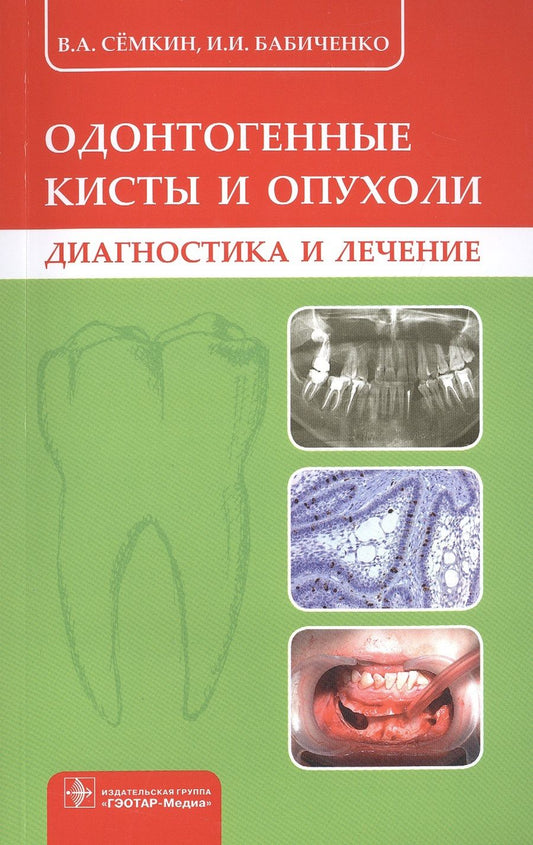 Обложка книги "Семкин, Бабиченко: Одонтогенные кисты и опухоли. Диагностика и лечение"