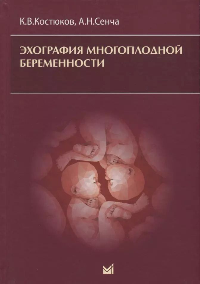 Обложка книги "Сенча, Костюков: Эхография многоплодной беременности"