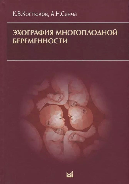 Обложка книги "Сенча, Костюков: Эхография многоплодной беременности"