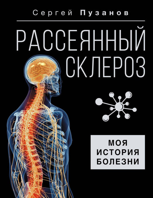 Обложка книги "Сергей Пузанов: Рассеянный склероз. Моя история болезни"