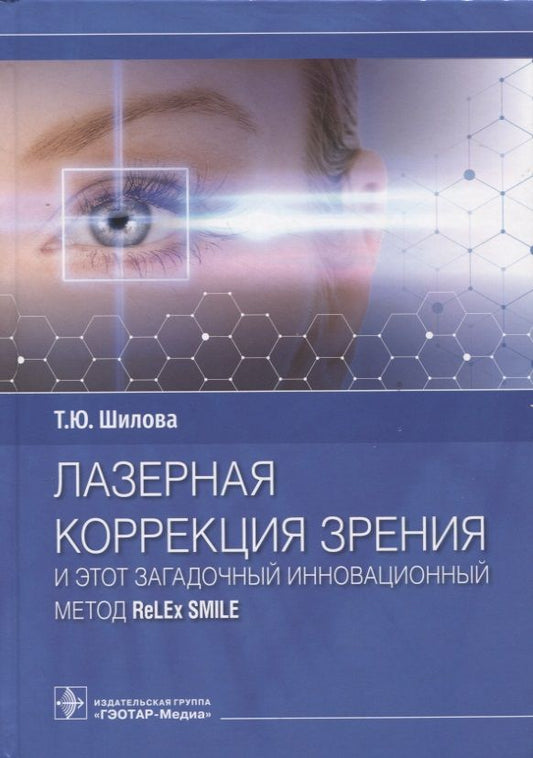 Обложка книги "Шилова: Лазерная коррекция зрения и этот загадочный инновационный метод ReLEx SMILE"