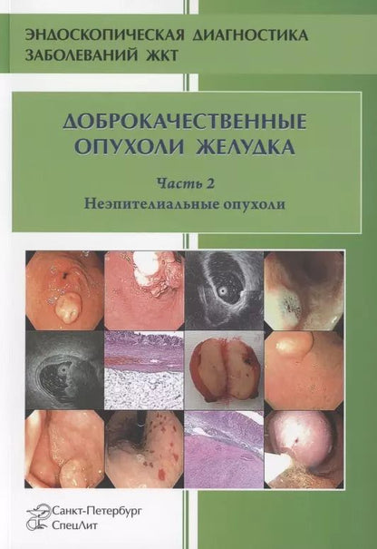 Обложка книги "Шкалова, Кузин, Добронец, Радовский: Доброкачественные опухоли желудка. Часть 2 Неэпителиальные опухоли"