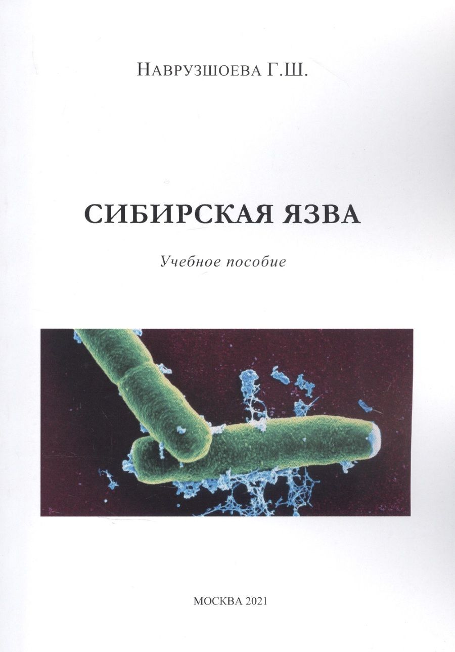 Обложка книги "Сибирская язва"