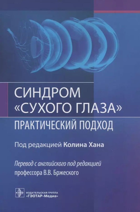 Обложка книги "Синдром "сухого глаза". Практический подход"