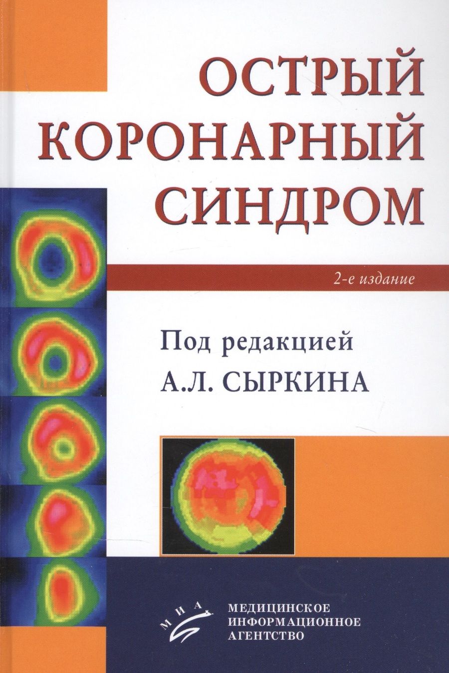Обложка книги "Сыркин АбрамОстрый коронарный синдром"