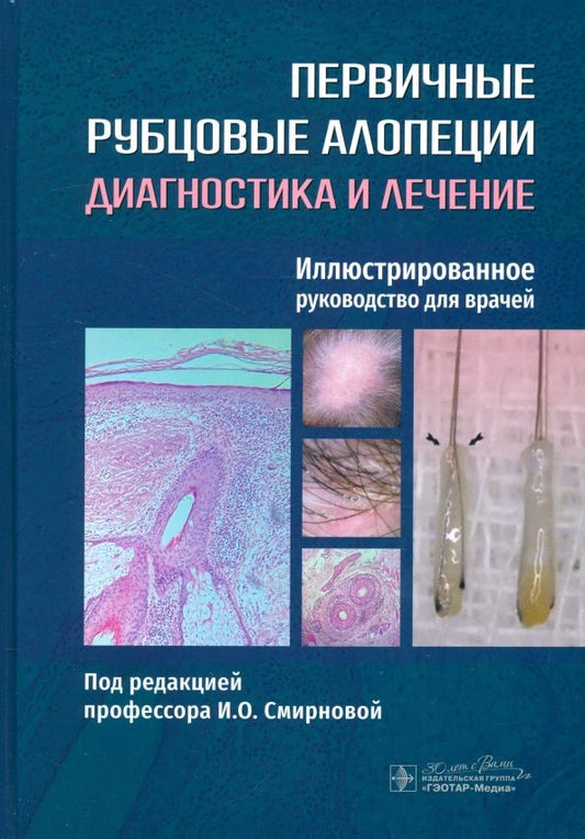 Обложка книги "Смирнова, Бессалова, Волков: Первичные рубцовые алопеции. Диагностика и лечение. Иллюстрированное руководство для врачей"