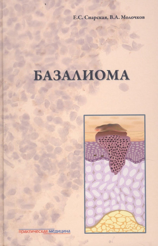 Обложка книги "Снарская, Молочков: Базалиома"