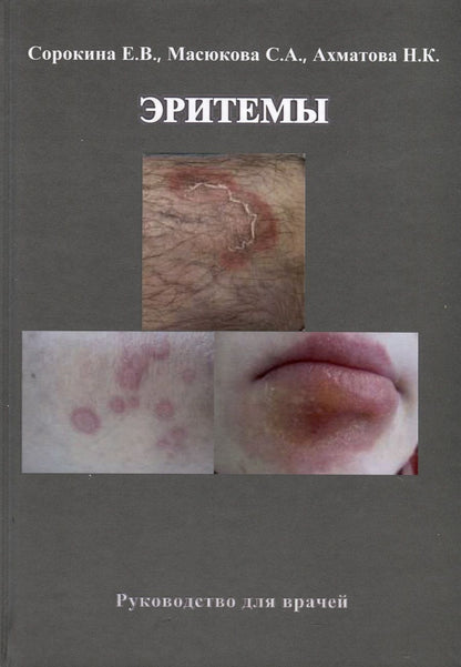Обложка книги "Сорокина, Ахматова: Эритемы. Руководство для врачей"