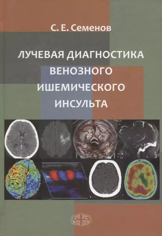Обложка книги "Станислав Семенов: Лучевая диагностика венозного ишемического инсульта"