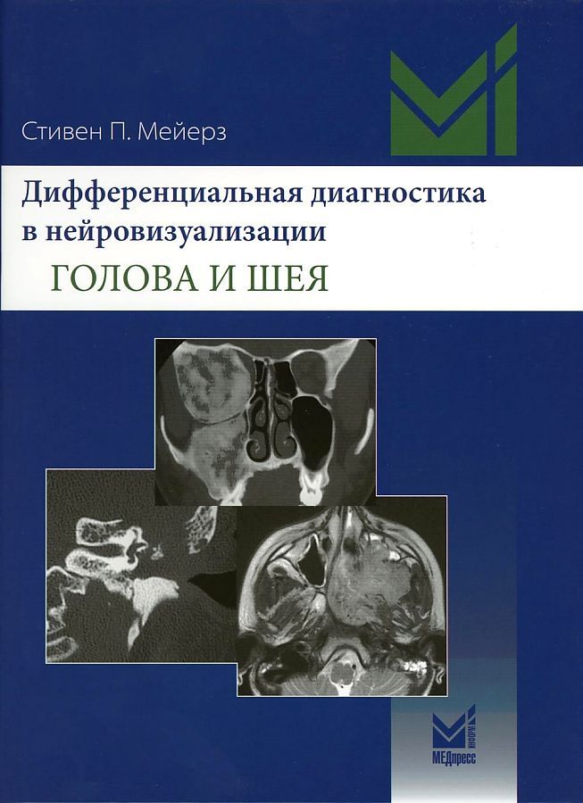 Обложка книги "Стивен П.: Дифференциальная диагностика в нейровизуализации. Голова и шея"