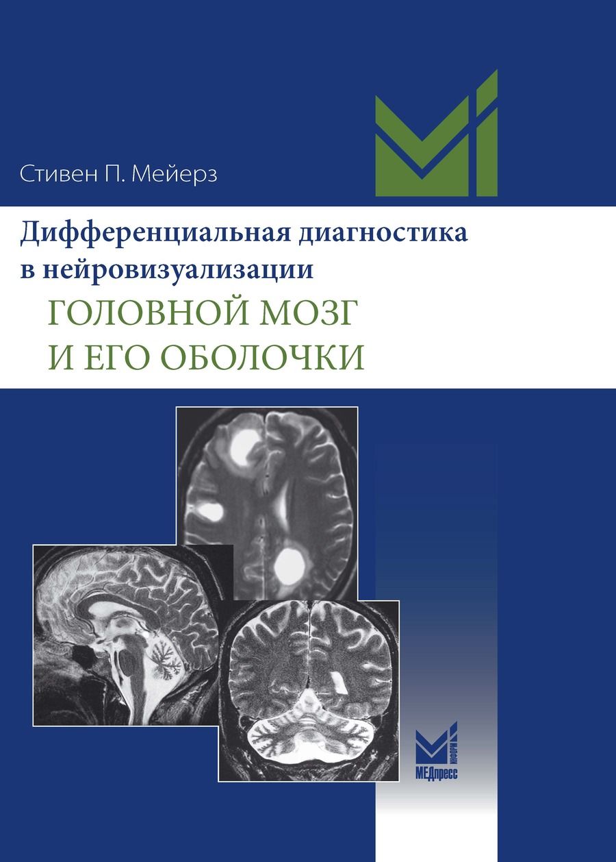 Обложка книги "Стивен П.: Дифференциальная диагностика в нейровизуализации. Головной мозг и его оболочки"