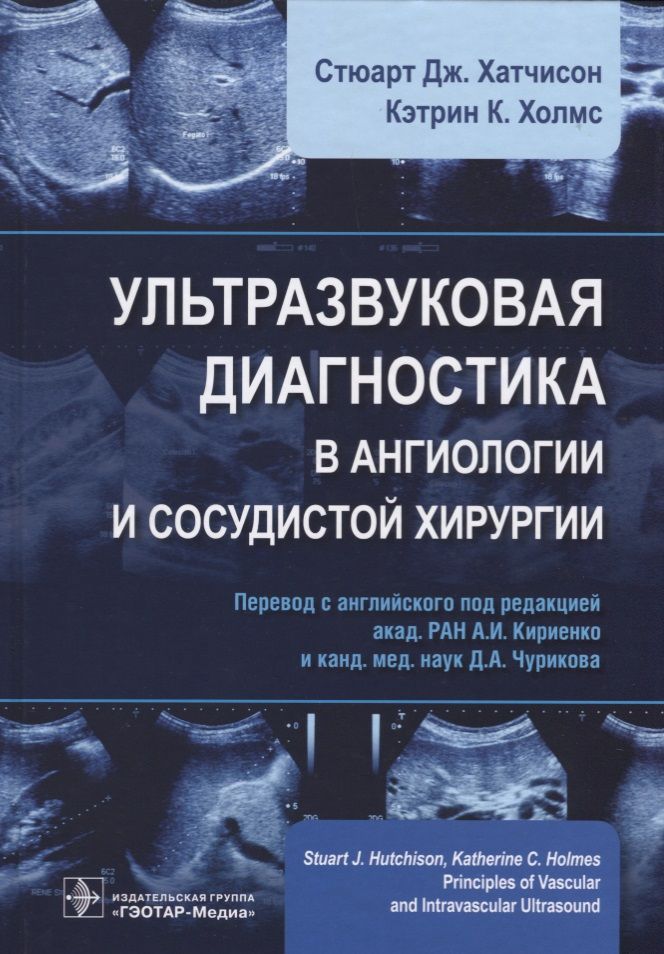 Обложка книги "Стюарт Дж.: Ультразвуковая диагностика в ангиологии и сосудистой хирургии (Хатчисон)"