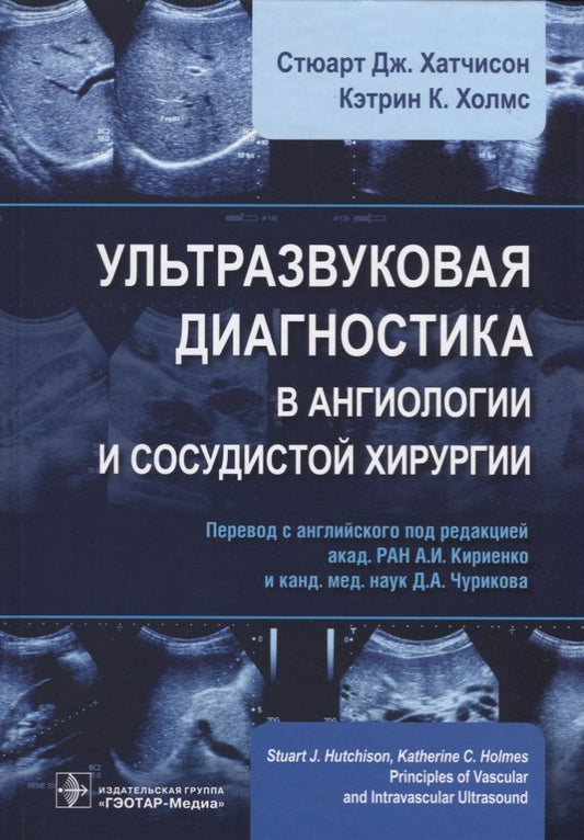 Обложка книги "Стюарт Дж.: Ультразвуковая диагностика в ангиологии и сосудистой хирургии (Хатчисон)"