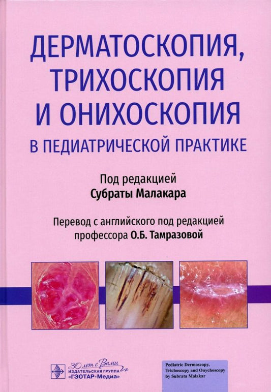 Обложка книги "Субрата Малакар: Дерматоскопия, трихоскопия и онихоскопия в педиатрической практике"