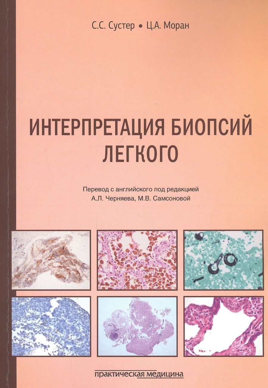 Обложка книги "Сустер, Моран: Интерпретация биопсий легкого"