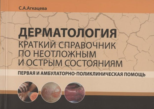 Обложка книги "Светлана Агкацева: Дерматология. Краткий справочник по неотложным и острым состояниям. Первая и амбулаторно-поликлиническая помощь"