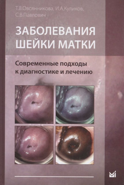 Обложка книги "Тамара Овсянникова: Заболевания шейки матки. Современные подходы к диагностике и"