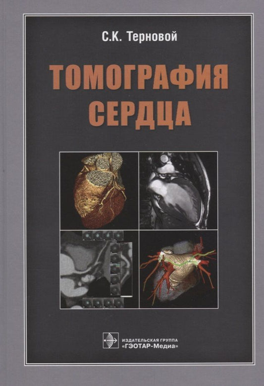 Обложка книги "Терновой, Белькинд, Веселова: Томография сердца. Руководство для врачей"