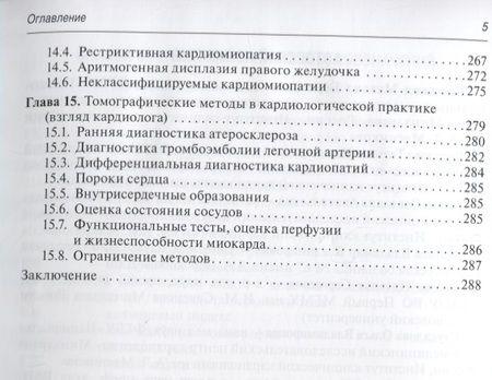 Фотография книги "Терновой, Белькинд, Веселова: Томография сердца. Руководство для врачей"