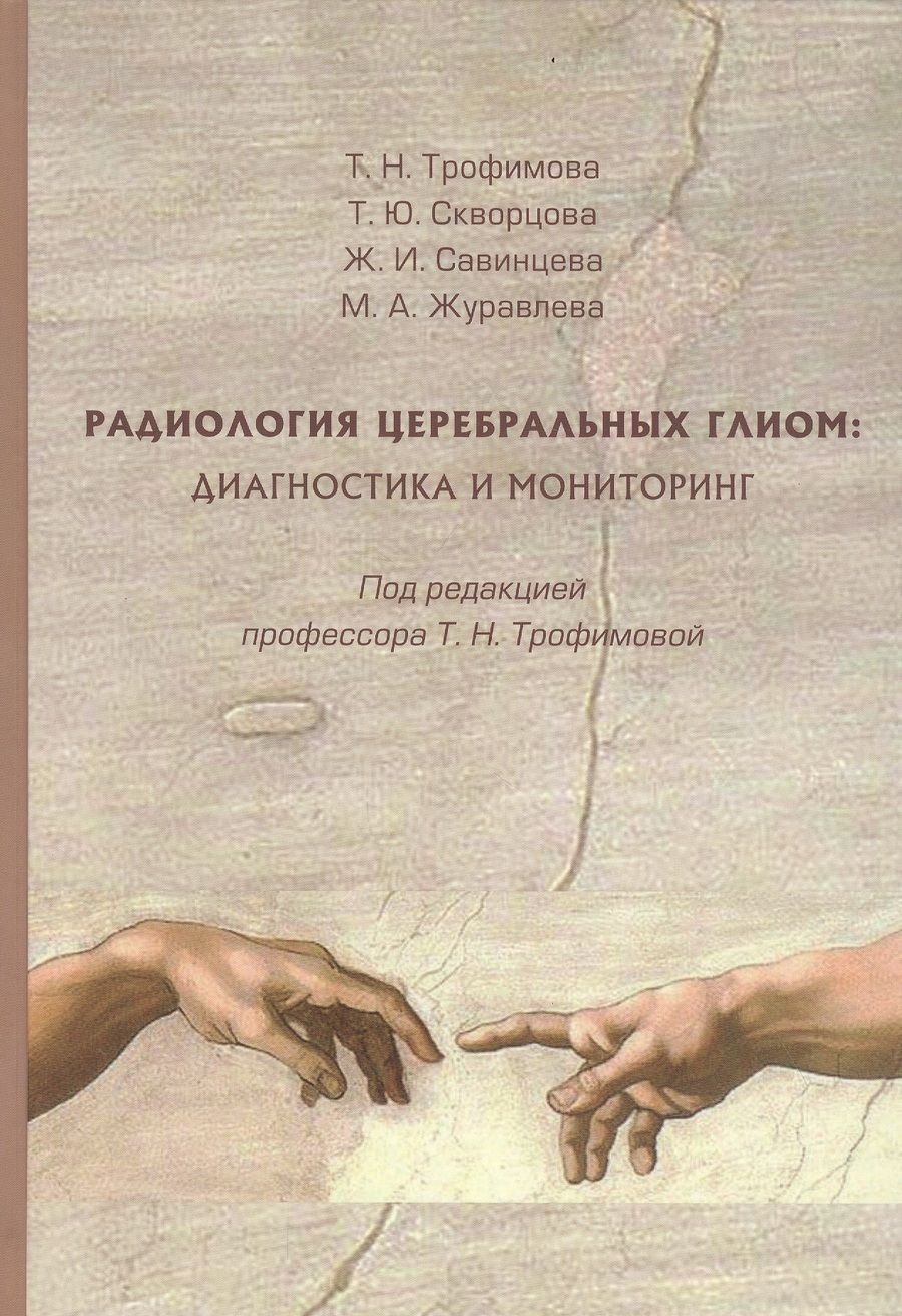 Обложка книги "Трофимова, Скворцова, Савинцева: Радиология церебральных глиом. Диагностика и мониторинг"