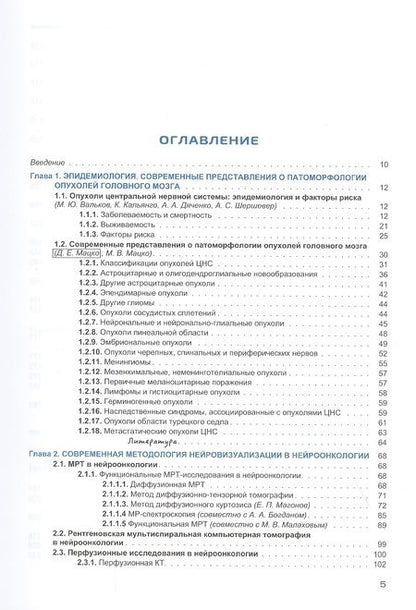 Фотография книги "Трофимова, Скворцова, Савинцева: Радиология церебральных глиом. Диагностика и мониторинг"