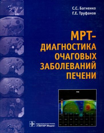 Обложка книги "Труфанов, Багненко: МРТ-диагностика очаговых заболеваний печени"