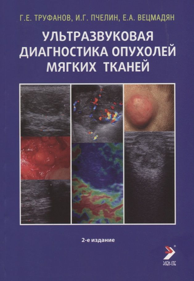 Обложка книги "Труфанов: Ультразвуковая диагностика опухолей мягких тканей"