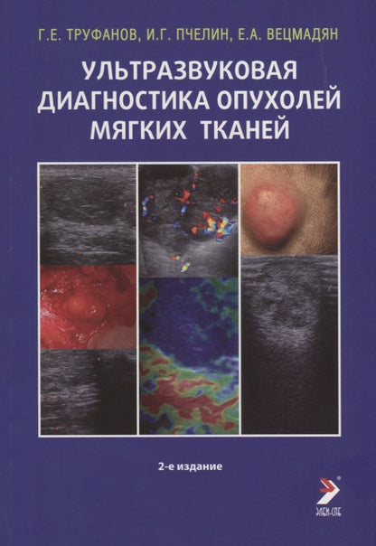 Обложка книги "Труфанов: Ультразвуковая диагностика опухолей мягких тканей"