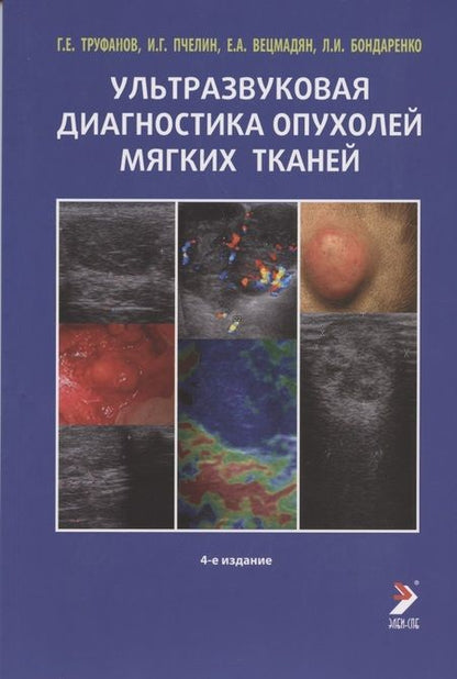 Фотография книги "Труфанов: Ультразвуковая диагностика опухолей мягких тканей"