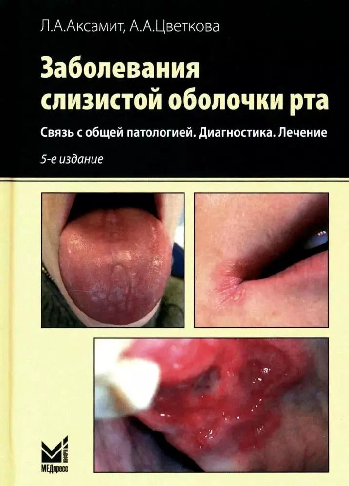 Обложка книги "Цветкова, Аксамит: Заболевания слизистой оболочки рта. Связь с общей патологией. Диагностика. Лечение"