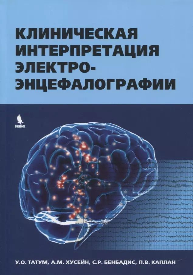 Обложка книги "У.О. Татум: Клиническая интерпретация электроэнцефалографии"