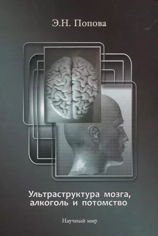 Обложка книги "Ультраструктура мозга, алкоголь и потомство"
