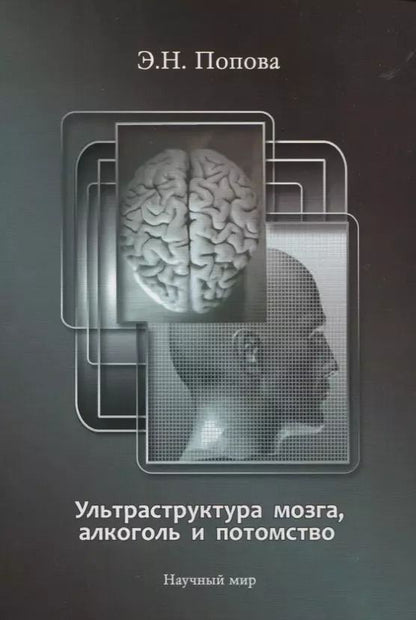 Обложка книги "Ультраструктура мозга, алкоголь и потомство"