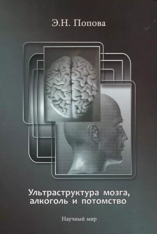 Обложка книги "Ультраструктура мозга, алкоголь и потомство"