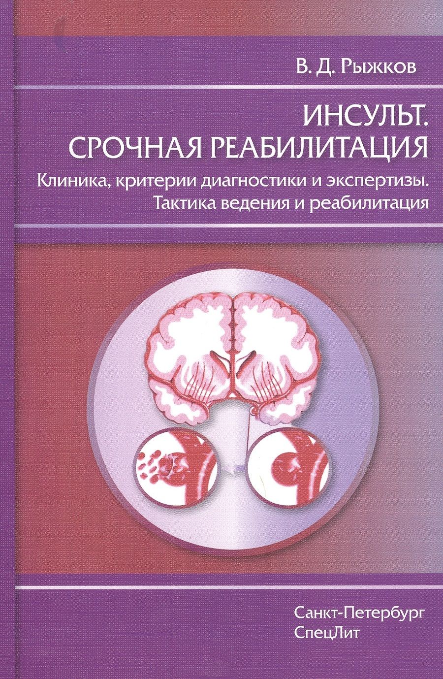 Обложка книги "Валерий Рыжков: Инсульт.Срочная реабилитация"