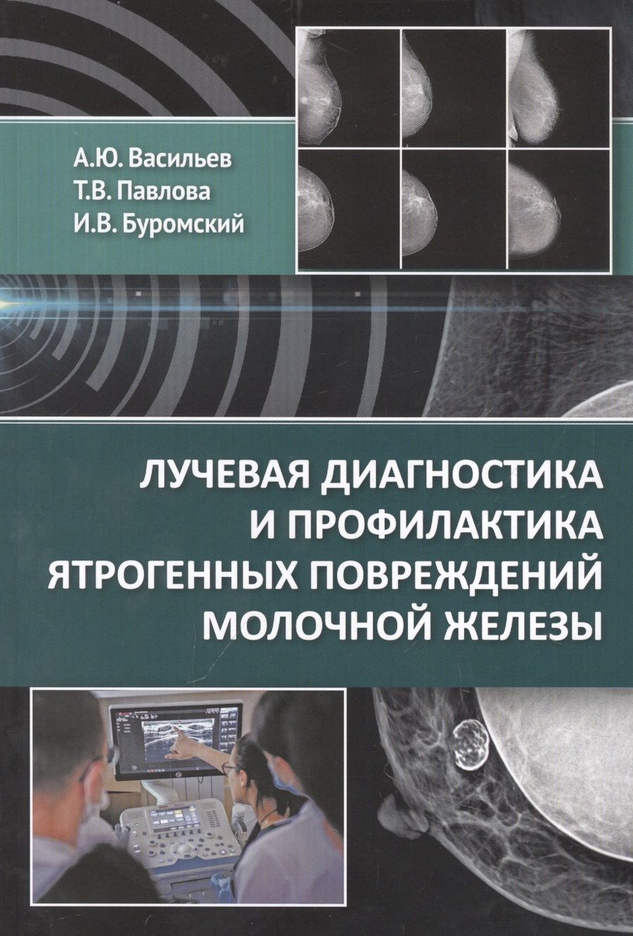 Обложка книги "Васильев, Павлова, Буромский: Лучевая диагностика и профилактика ятрогенных повреждений молочной железы"