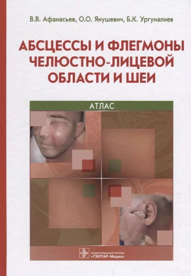 Обложка книги "Василий Афанасьев: Абсцессы и флегмоны челюстно-лицевой области и шеи 18-19г."