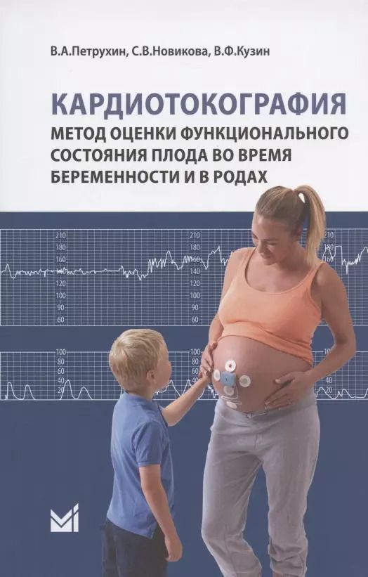 Обложка книги "Василий Петрухин: Кардиотокография. Метод оценки функционального состояния плода во время беременности и в родах. Учебное пособие"